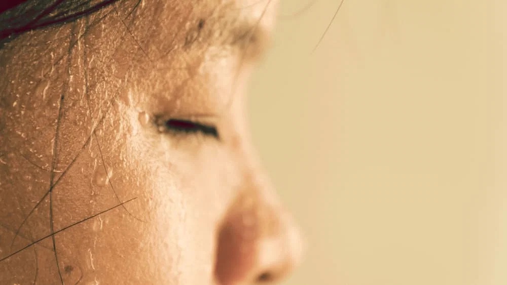 Facial Hyperhidrosis Treatment in Perth by Perth Sweat Clinic